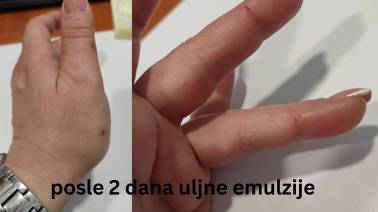 Zašto je Sanovita uljna emulzija sastavni deo moje kućne apoteke