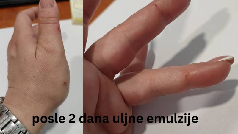Zašto je Sanovita uljna emulzija sastavni deo moje kućne apoteke